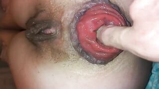 Fuck my Juicy Prolapse