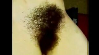 hairy russian 2 2