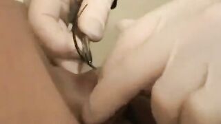 Sewn Shaved Pussy