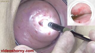 Japanese Endoscope Camera inside Cervix Cam into Pussy