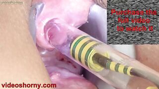 Woman Pee Hole Playing, Urethral Insertion with Endoscope Cam