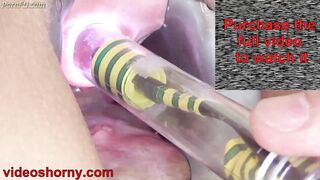 Woman Pee Hole Playing, Urethral Insertion with Endoscope Cam